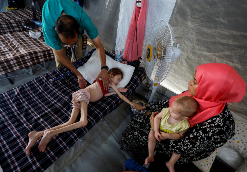 Malnourished Palestinian children receive treatment at the IMC field hospital in Deir Al-Balah, central Gaza Strip